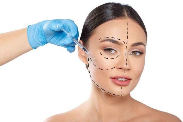 Harmonização facial: 5 mitos sobre o procedimento da moda