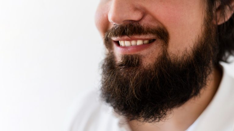 Transplante é a nova opção para quem quer ter barba volumosa