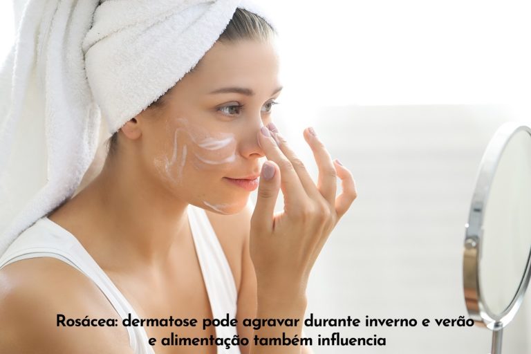 Rosácea: dermatose pode agravar durante inverno e verão, e alimentação também influencia