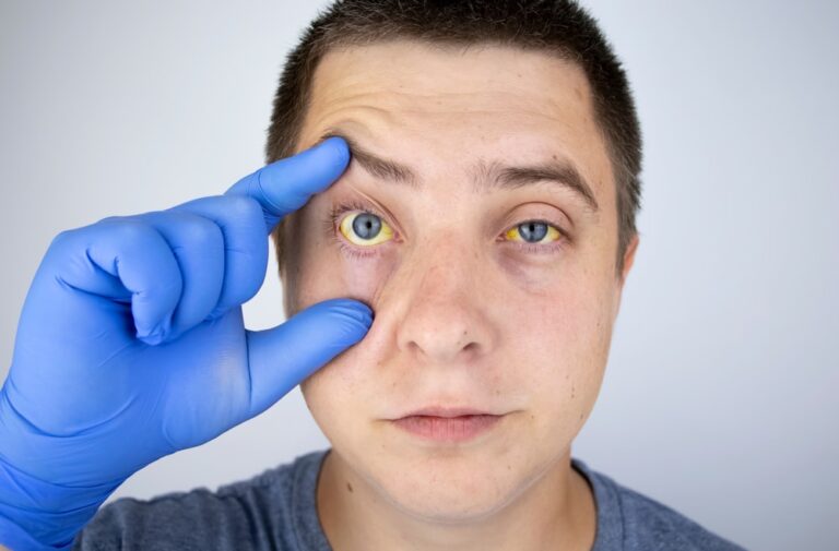 Julho Amarelo: tudo que você precisa saber sobre hepatites virais