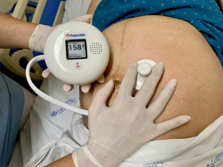 Hapvida NotreDame Intermédica e Senai Ceará lançam detector de frequência cardíaca fetal com Inteligência Artificial
