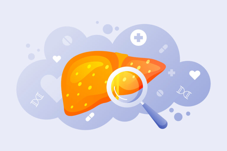 Acúmulo de gordura no fígado pode aumentar em 30% o risco de diabetes