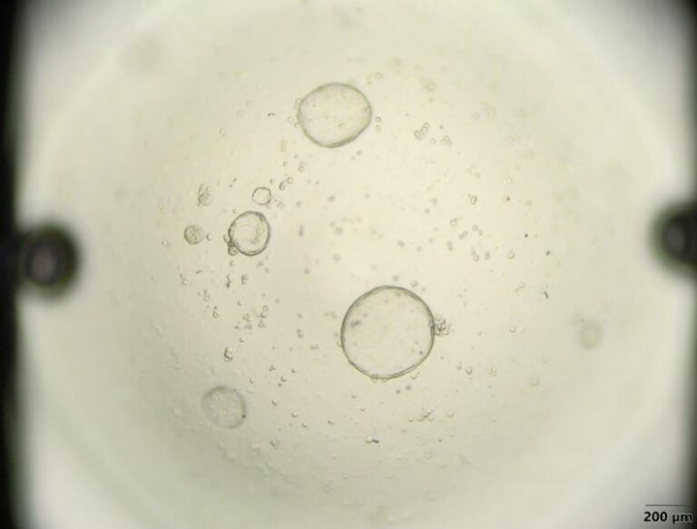 Organoides tumorais bioimpressos aprimorados ajudam a prever a resposta ao tratamento