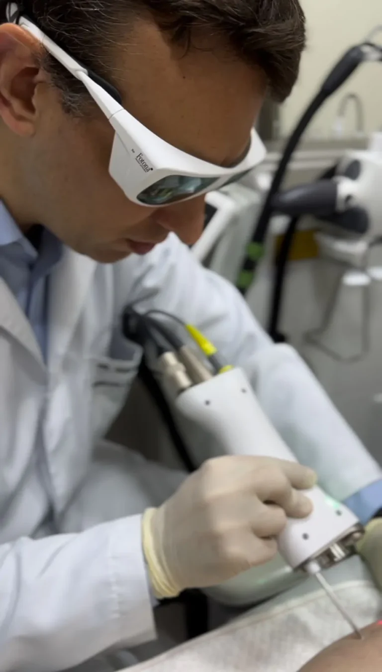 TRATAMENTO DE ‘VASINHOS’ NAS PERNAS COM LASER TRANSDÉRMICO