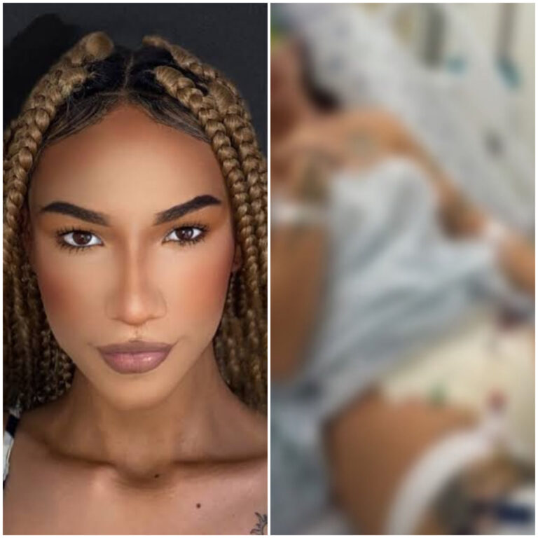 Aos 17 anos, Croislla, passa por cirurgia de redesignação e alteração de gênero; “Prazer, Eduarda!”