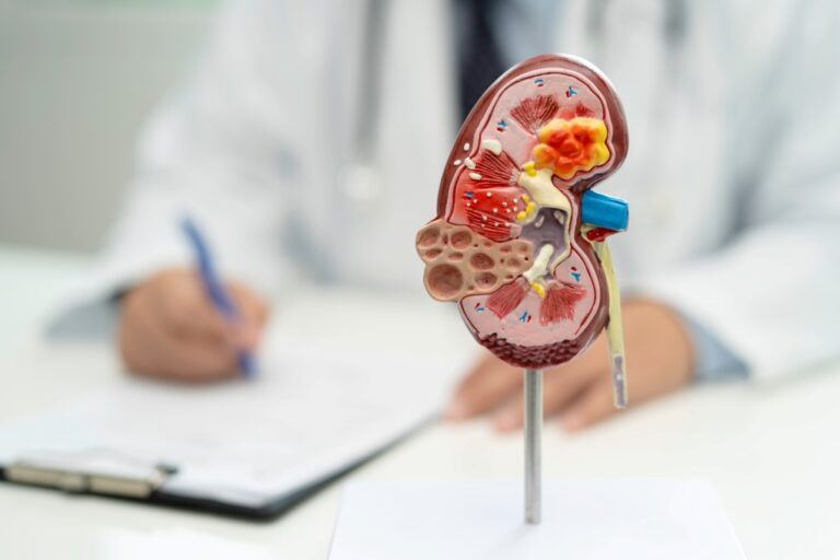 Estudo da Hapvida NotreDame Intermédica indica que cerca de 4% dos beneficiários adultos têm algum grau de doença renal crônica
