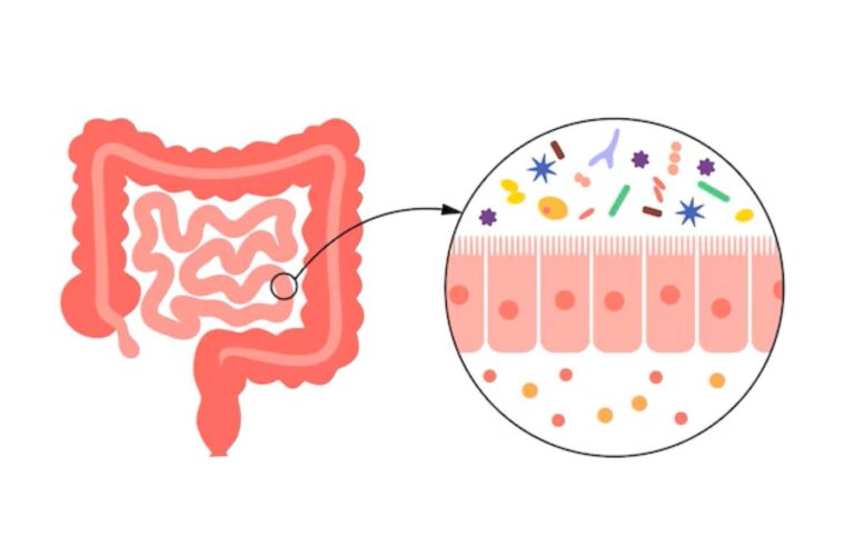 Março Azul-Marinho lembra a importância da prevenção contra o câncer de intestino